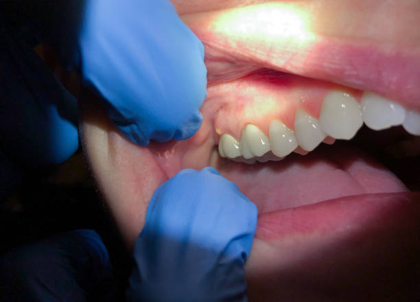 Best Emergency Treatment for Jaw Pain or Injury in Chatham, IL